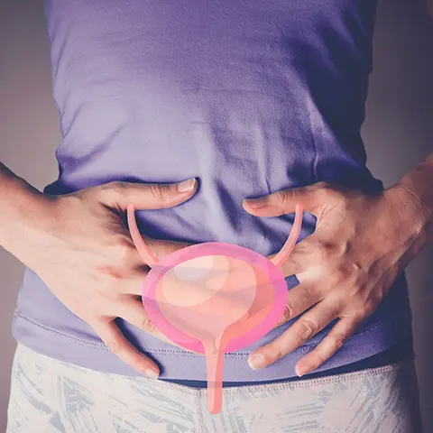 Interstitial Cystitis