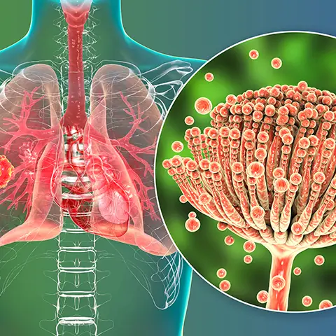 Mold Toxicity & Biotoxins